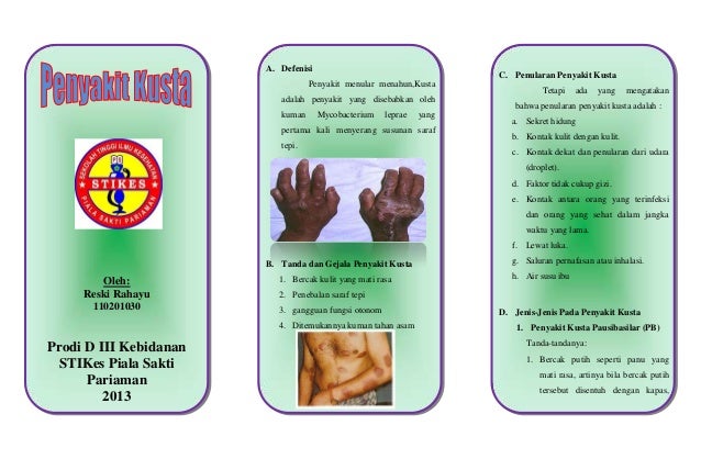 Leaflet penyakit kusta
