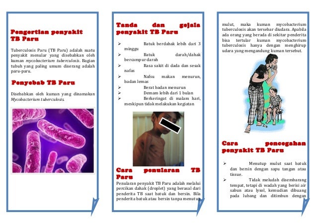 Leaflet Tbc Akper Raha 2
