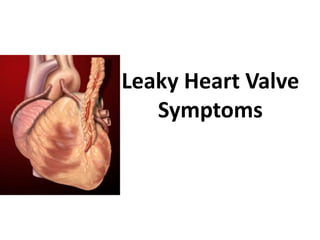 Leaky Heart Valve
Symptoms
By Asian Heart Institute
 