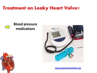 Asian Heart Institute - Leaky heart valve symptoms | PPTX