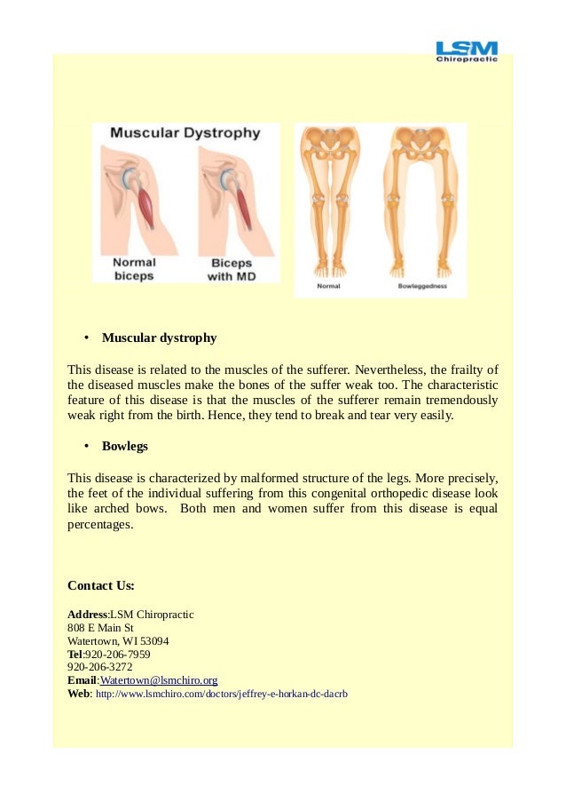 Learn About Some Typically Orthopedic Inborn Ailments