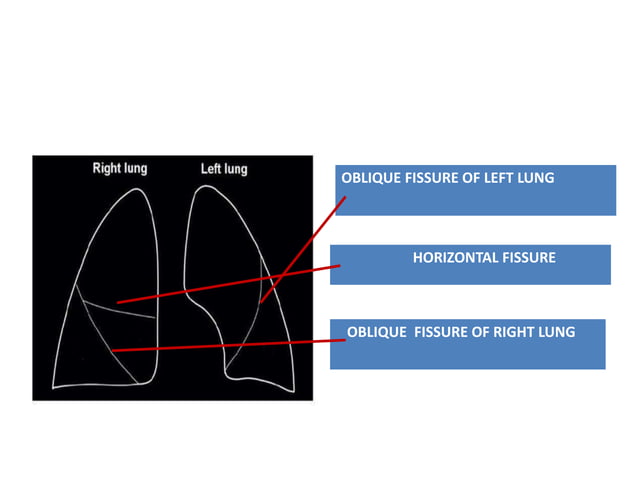 Learn Chest X-Ray With Its Normal Positioning & Radio-Anatomy | PPTX