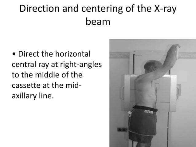 Learn Chest X-Ray With Its Normal Positioning & Radio-Anatomy | PPTX