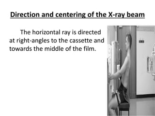Learn Chest X-Ray With Its Normal Positioning & Radio-Anatomy