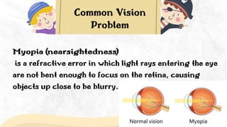 Vision Problems Light Rays Learners with Difficulty in Seeing or Learners with Visual Impairment.pptx