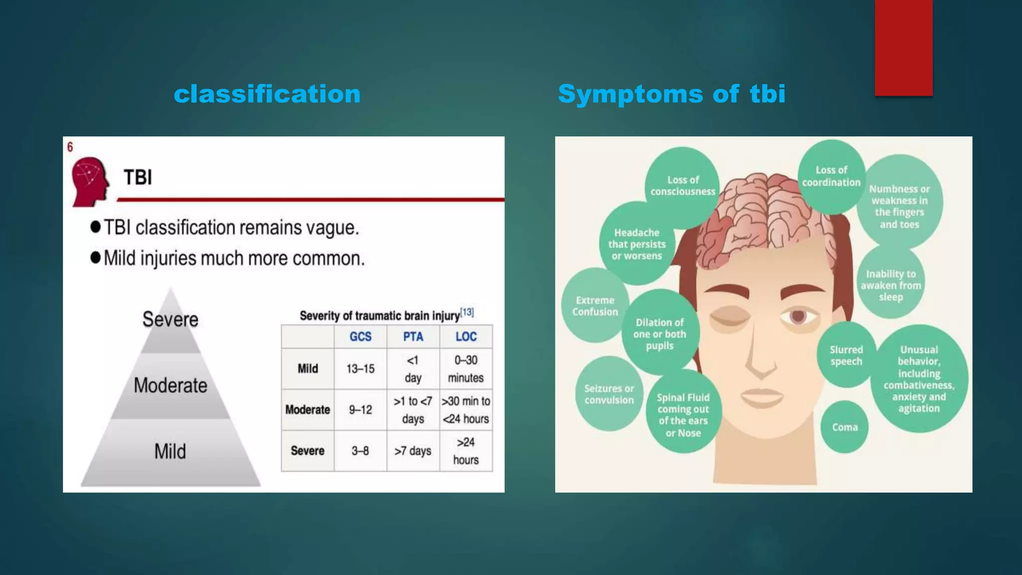 classification Symptoms of tbi
 
