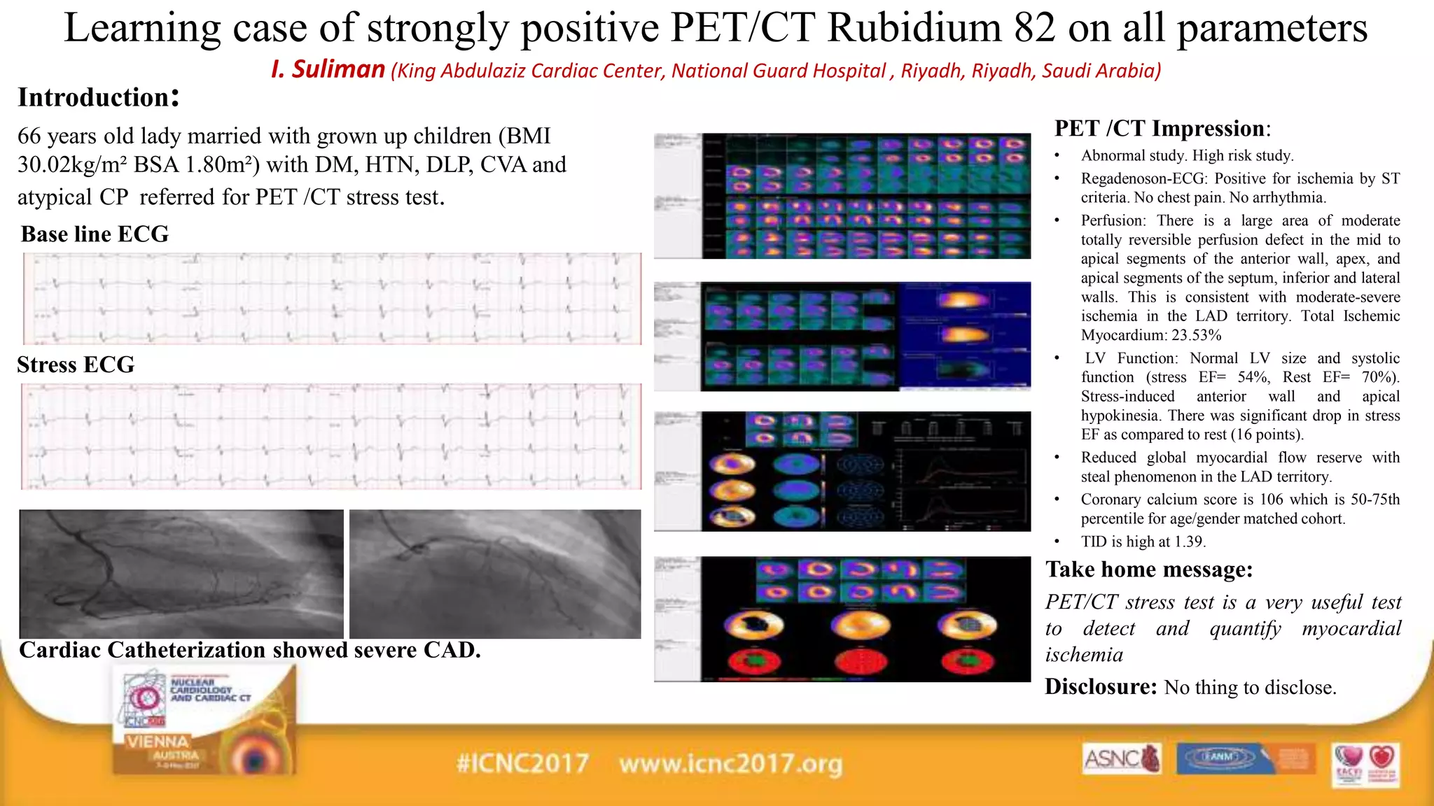 Learning case of strongly positive PET-CT Rubidium 82 on all parameters.ppt