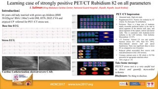 Learning case of strongly positive PET-CT Rubidium 82 on all parameters.ppt