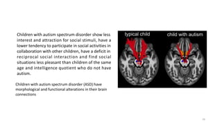 Children with autism spectrum disorder show less
interest and attraction for social stimuli, have a
lower tendency to participate in social activities in
collaboration with other children, have a deficit in
reciprocal social interaction and find social
situations less pleasant than children of the same
age and intelligence quotient who do not have
autism.
Children with autism spectrum disorder (ASD) have
morphological and functional alterations in their brain
connections
24
 