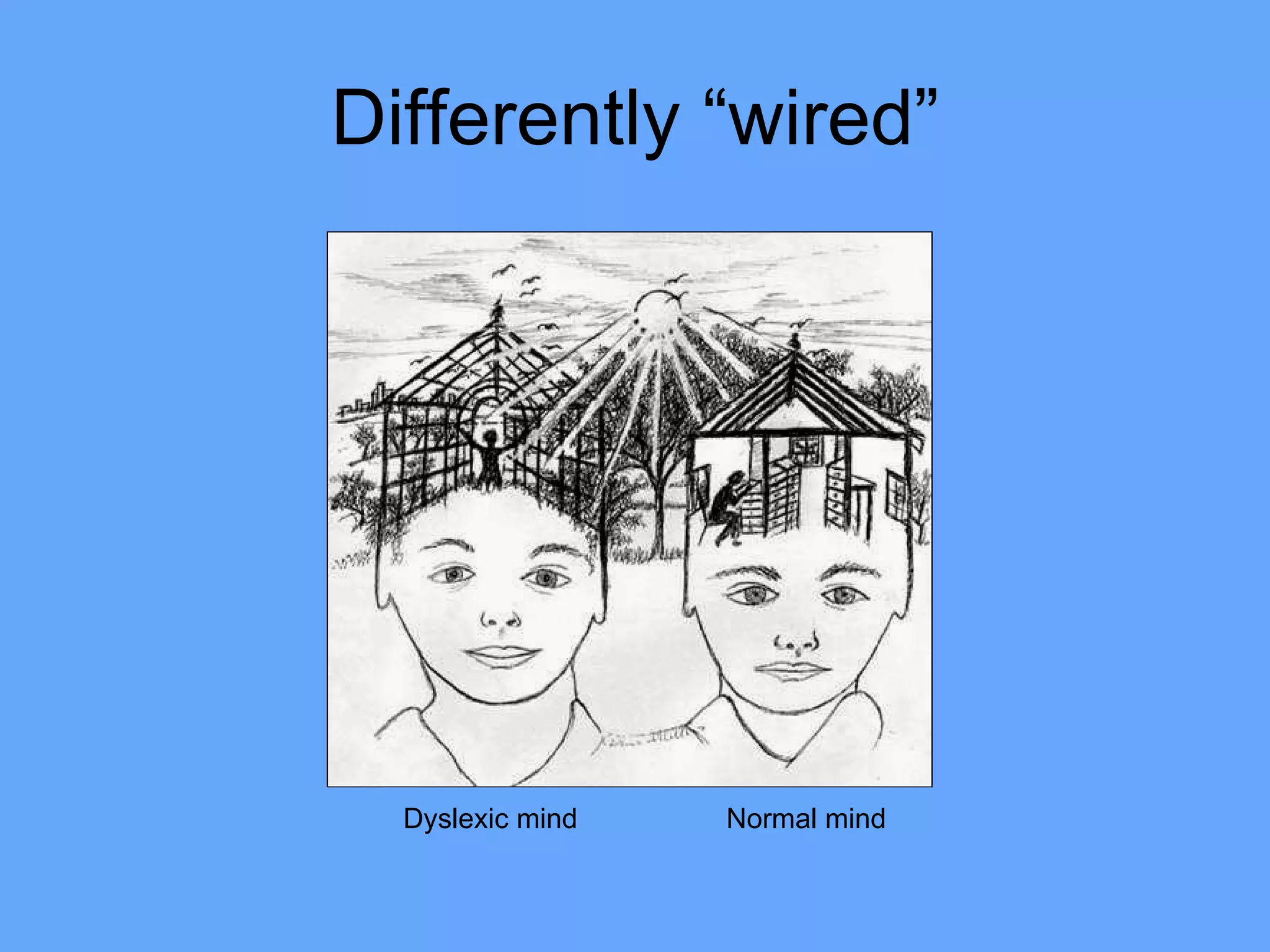 Differently “wired” Dyslexic mind  Normal mind 