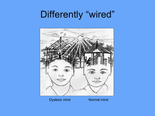 Differently “wired” Dyslexic mind  Normal mind 