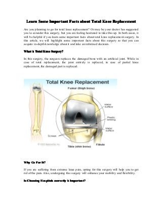 Learn Some Important Facts about Total Knee Replacement
Are you planning to go for total knee replacement? Or may be your doctor has suggested
you to consider this surgery, but you are feeling hesitated to take this up. In both cases, it
will be helpful if you learn some important facts about total knee replacement surgery. In
this article, we will highlight some important facts about this surgery so that you can
acquire in-depth knowledge about it and take an informed decision.

What is Total Knee Surgery?

In this surgery, the surgeon replaces the damaged bone with an artificial joint. While in
case of total replacement, the joint entirely is replaced, in case of partial knee
replacement, the damaged part is replaced.




Why Go For It?

If you are suffering from extreme knee pain, opting for this surgery will help you to get
rid of the pain. Also, undergoing this surgery will enhance your mobility and flexibility.

Is Choosing Hospitals correctly is Important?
 