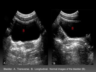 Learn ultrasonography | PPTX