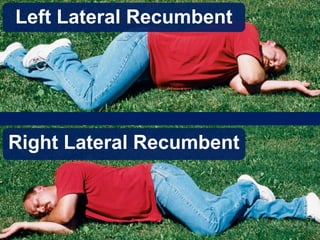 Left Lateral Recumbent
Right Lateral Recumbent
 