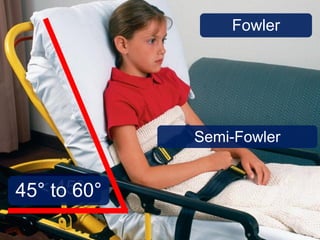 Fowler
Semi-Fowler
< 45°45° to 60°
 