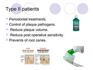 Type II patients
Periodontal treatments.
Control of plaque pathogens.
 Reduce plaque volume.
 Reduce post operative sensitivity.
Prevents of root caries.
 