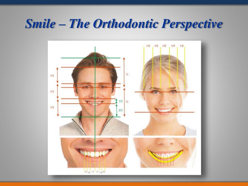 smile analysis in Orthodontics