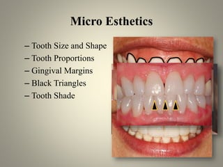 Micro Tooth orthodontic diagnosis - Examination history | PPTX