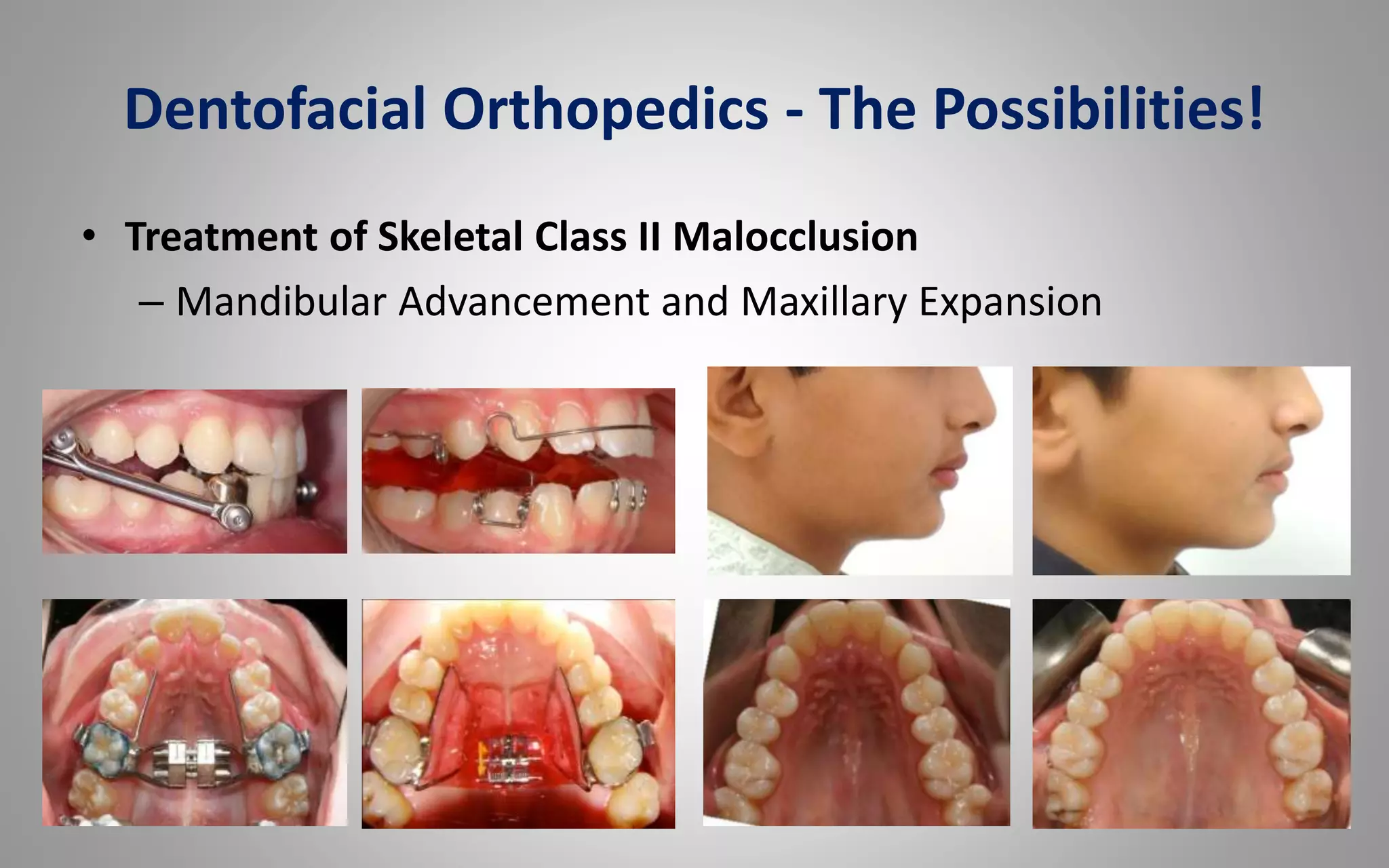 Lec. 07. skeletal and dental maturity indicators | PPTX