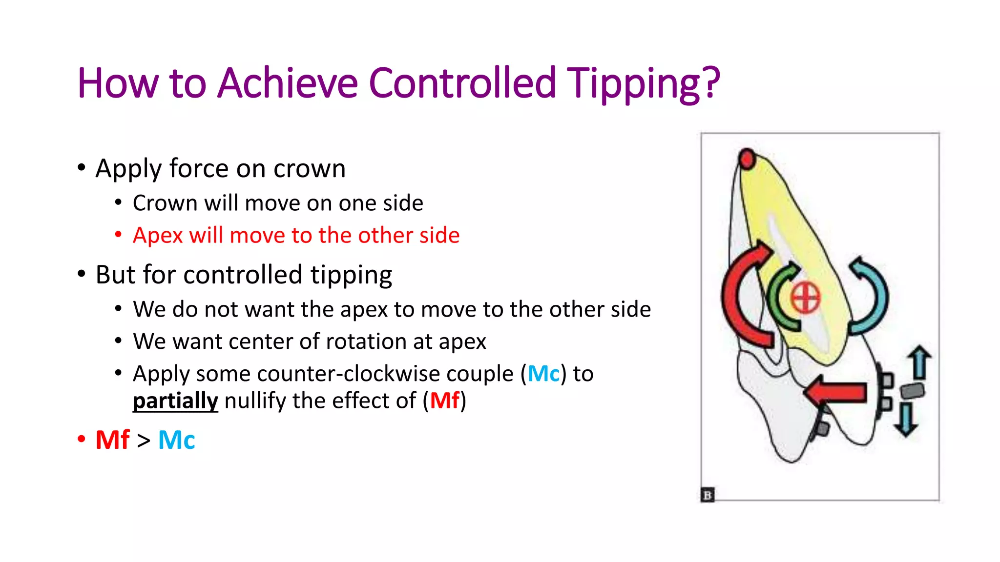 basics of orthodontic force system | PPTX