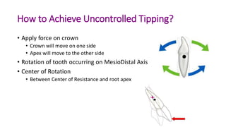 basics of orthodontic force system | PPTX