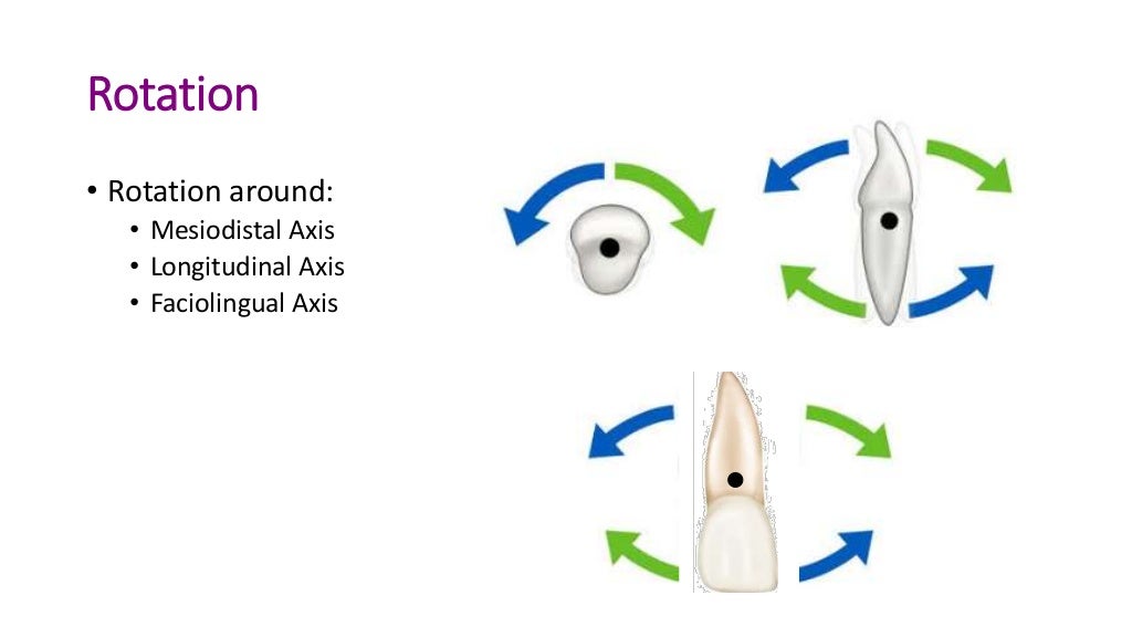 basics of orthodontic force system