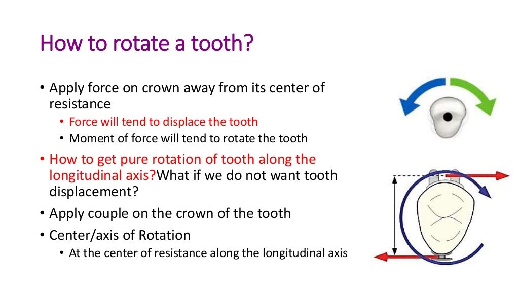 basics of orthodontic force system