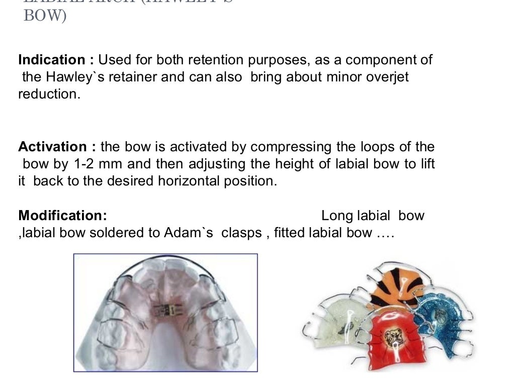 removable orthodontic appliances
