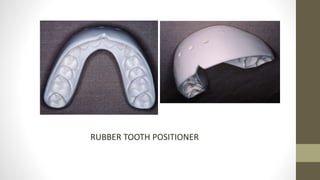 Tooth Positioner Retainer Retention and relapse | PPTX