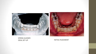 Retention and relapse | PPTX