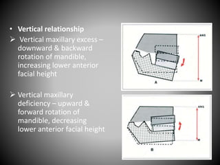 • Vertical relationship
 Vertical maxillary excess –
downward & backward
rotation of mandible,
increasing lower anterior
facial height
 Vertical maxillary
deficiency – upward &
forward rotation of
mandible, decreasing
lower anterior facial height
 