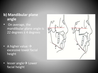 b) Mandibular plane
angle
• On average, the
mandibular plane angle is
22 degrees ± 4 degrees
• A higher value 
excessive lower facial
height
• lesser angle Lower
facial height
 