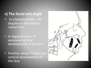 c) The facial axis angle
• In a balanced face --90
degrees to the basion-
nasion line
• A negative value 
excessive vertical
development of the face
• Positive values  deficient
vertical development of
the face
 