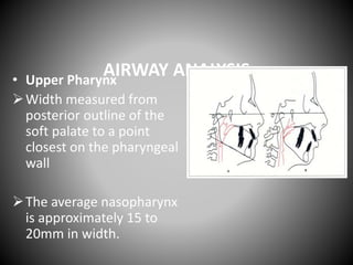 AIRWAY ANALYSIS• Upper Pharynx
Width measured from
posterior outline of the
soft palate to a point
closest on the pharyngeal
wall
The average nasopharynx
is approximately 15 to
20mm in width.
 