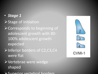 • Stage 1
Stage of initiation
Corresponds to beginning of
adolescent growth with 80-
100% adolescent growth
expected
Inferior borders of C2,C3,C4
were flat
Vertebrae were wedge
shaped
 