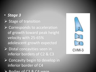 • Stage 3
 Stage of transition
 Corresponds to acceleration
of growth toward peak height
velocity with 25-65%
adolescent growth expected
 Distal concavities seen in
inferior borders of C2 & C3
 Concavity begin to develop in
inferior border of C4
 