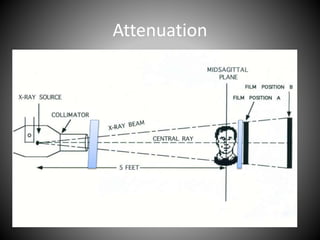 Attenuation
 