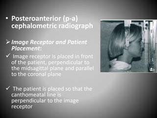 • Posteroanterior (p-a)
cephalometric radiograph
Image Receptor and Patient
Placement:
 Image receptor is placed in front
of the patient, perpendicular to
the midsagittal plane and parallel
to the coronal plane
 The patient is placed so that the
canthomeatal line is
perpendicular to the image
receptor
 