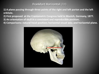 Frankfort Horizontal (FH)
1) A plane passing through three points of the right and left porion and the left
orbitale.
2) First proposed at the Craniometric Congress held in Munich, Germany, 1877.
3) An orientation of skull in a consistent and reproducible position.
4) Comparisons: natural head position; horizontal visual axis; and horizontal plane.
 