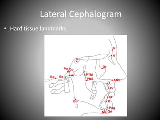 Lateral Cephalogram
• Hard tissue landmarks
 