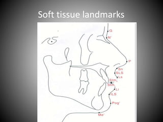 Soft tissue landmarks
 