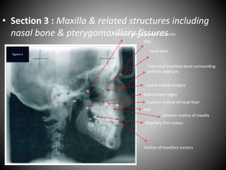 • Section 3 : Maxilla & related structures including
nasal bone & pterygomaxillary fissures
nasal bone
Thin nasal maxillary bone surrounding
piriform aperture
Lateral orbital margins
Bilateral key ridges
Bilateral pterygomaxillary fissures
ANS
Superior outline of nasal floor
PNS
Anterior outline of maxilla
Outline of maxillary incisors
Maxillary first molars
 