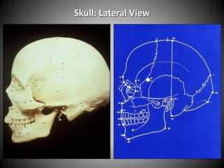 Skull: Lateral View
 