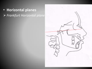 • Horizontal planes
 Frankfurt Horizontal plane
P
O
 