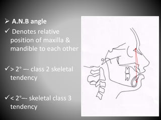  A.N.B angle
 Denotes relative
position of maxilla &
mandible to each other
> 2° –- class 2 skeletal
tendency
< 2°–- skeletal class 3
tendency
A
N
B
Mean value = 2°
 