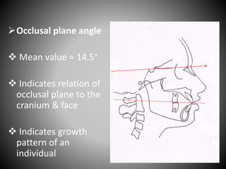 Occlusal plane angle
 Mean value = 14.5°
 Indicates relation of
occlusal plane to the
cranium & face
 Indicates growth
pattern of an
individual
S
N
 