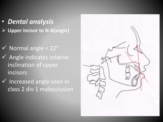 • Dental analysis
 Upper incisor to N-A(angle)
 Normal angle = 22°
 Angle indicates relative
inclination of upper
incisors
 Increased angle seen in
class 2 div 1 malocclusion
N
A
 
