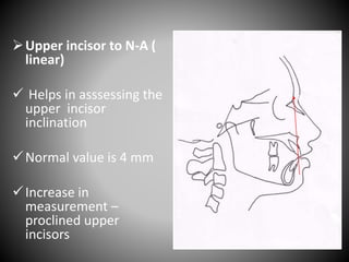 Upper incisor to N-A (
linear)
 Helps in asssessing the
upper incisor
inclination
Normal value is 4 mm
Increase in
measurement –
proclined upper
incisors
N
A
 