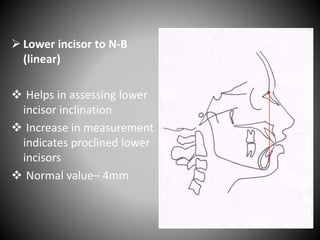  Lower incisor to N-B
(linear)
 Helps in assessing lower
incisor inclination
 Increase in measurement
indicates proclined lower
incisors
 Normal value– 4mm
N
B
 