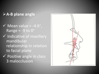 A-B plane angle
 Mean value = -4.6°,
Range = -9 to 0°
 Indicative of maxillary
mandibular
relationship in relation
to facial plane
 Positive angle in class
3 malocclusion
 